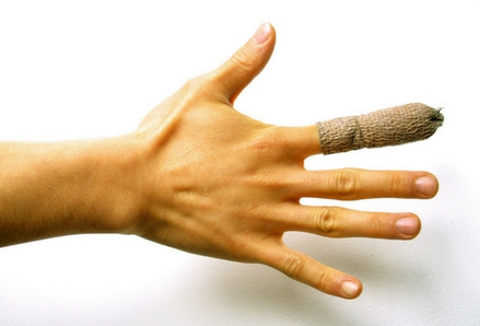 Hand with bandaged finger. Photo by FreeImages.com/Linden Laserna