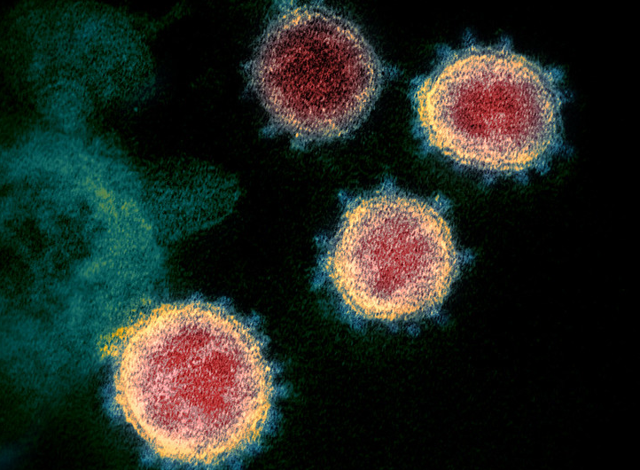 COVID-19 virus (SARS-CoV-2)